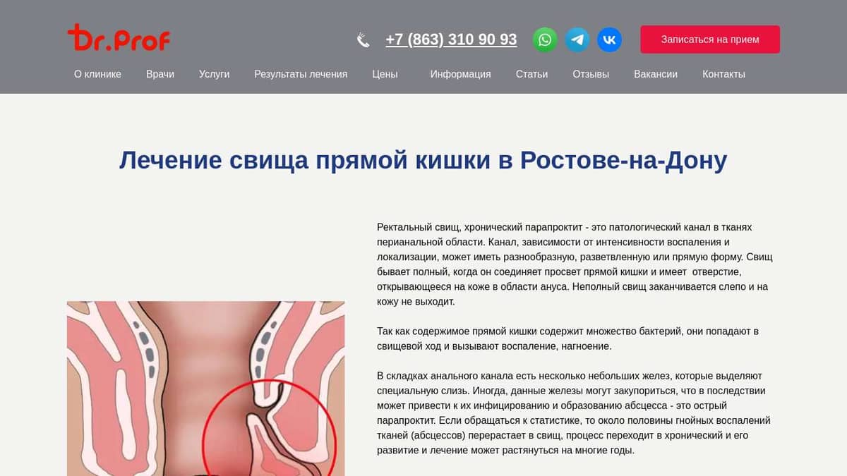 Лечение свища прямой кишки в Ростове по выгодной цене. Свищ прямой кишки-  Doctor-Prof