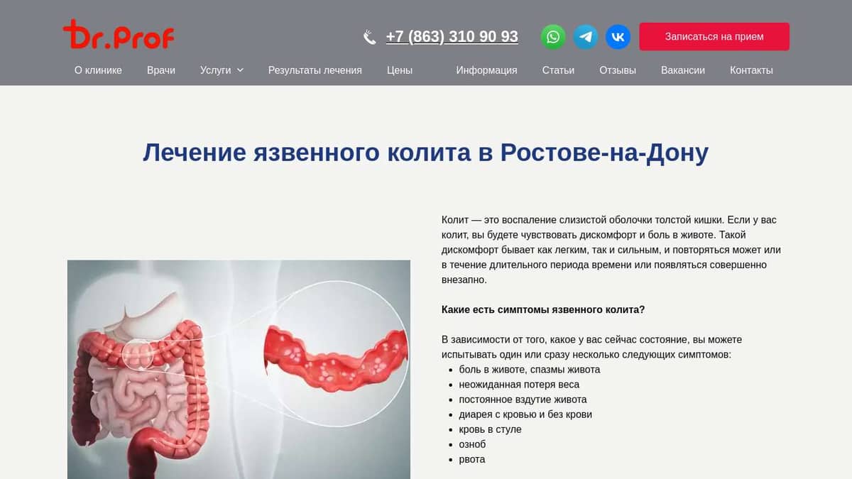 Лечение колита в Ростове по выгодной цене - Doctor-Prof