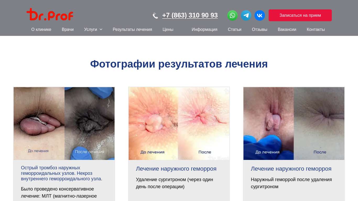 Анус домашнее 