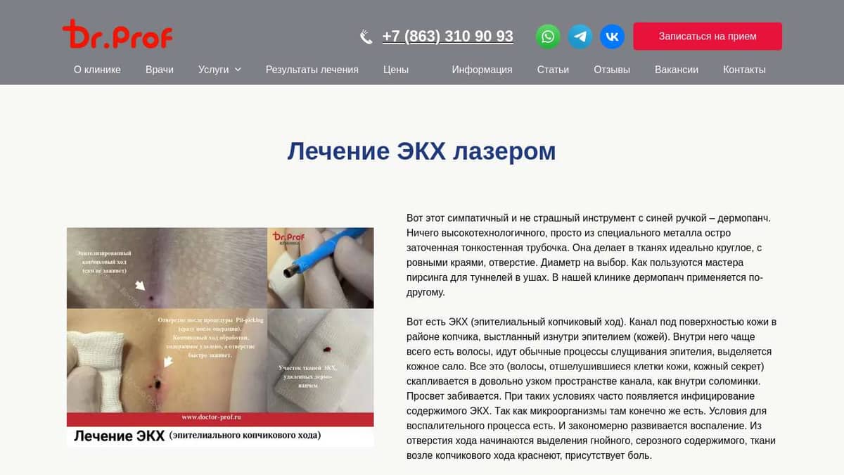 Лечение ЭКХ лазером в клинике в Ростове-на-Дону - Doctor-Prof