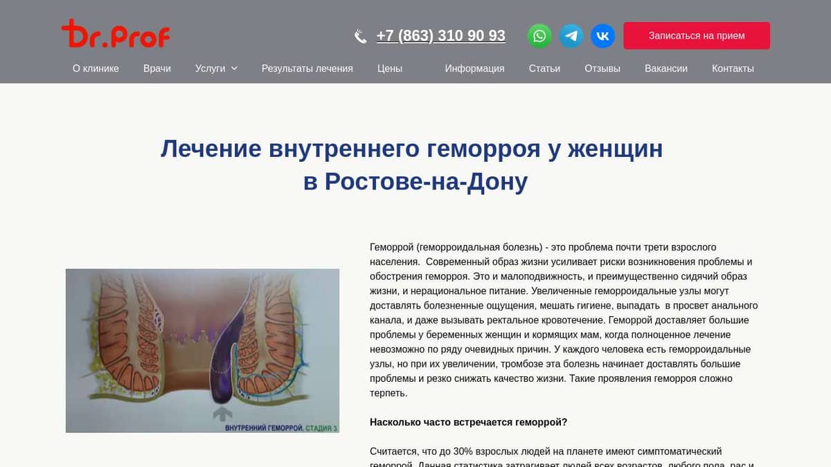 Лечение внутреннего геморроя у женщин в Ростове по выгодной цене -  Doctor-Prof