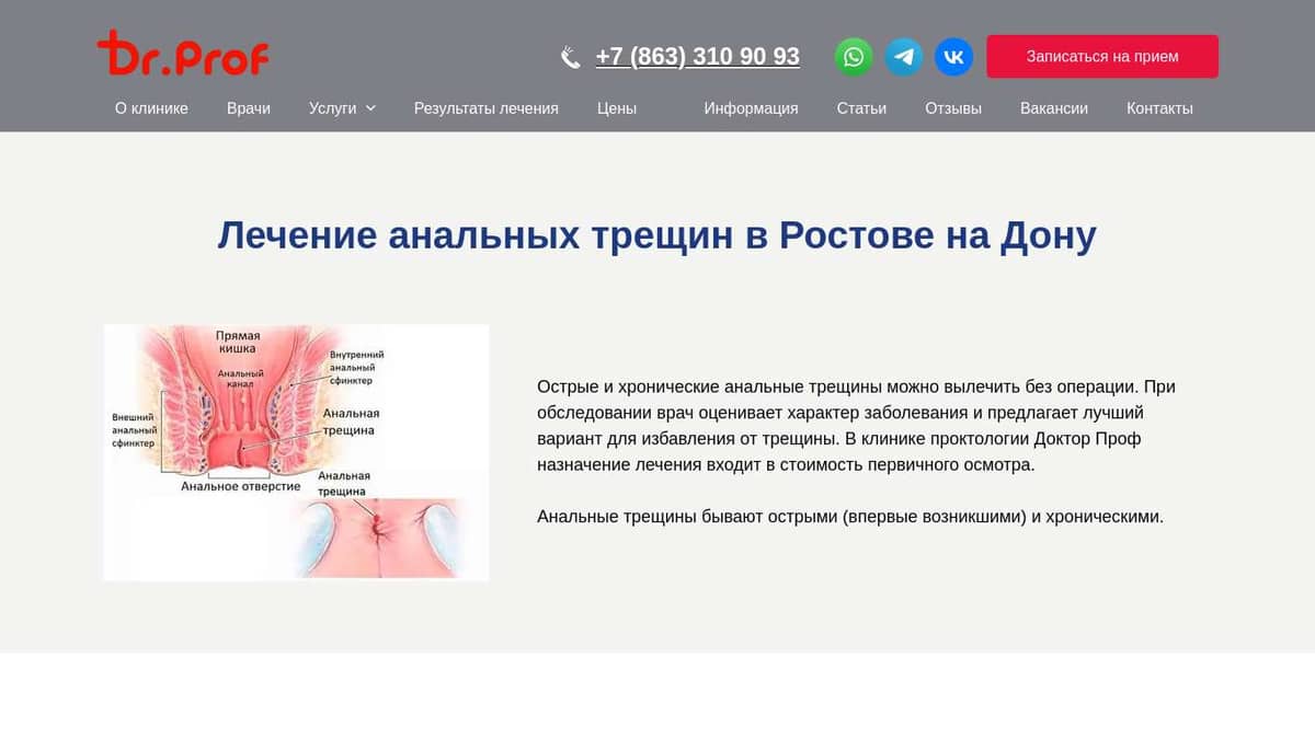 Лечение анальных трещин в Ростове-на-Дону - клиника Doctor-Prof